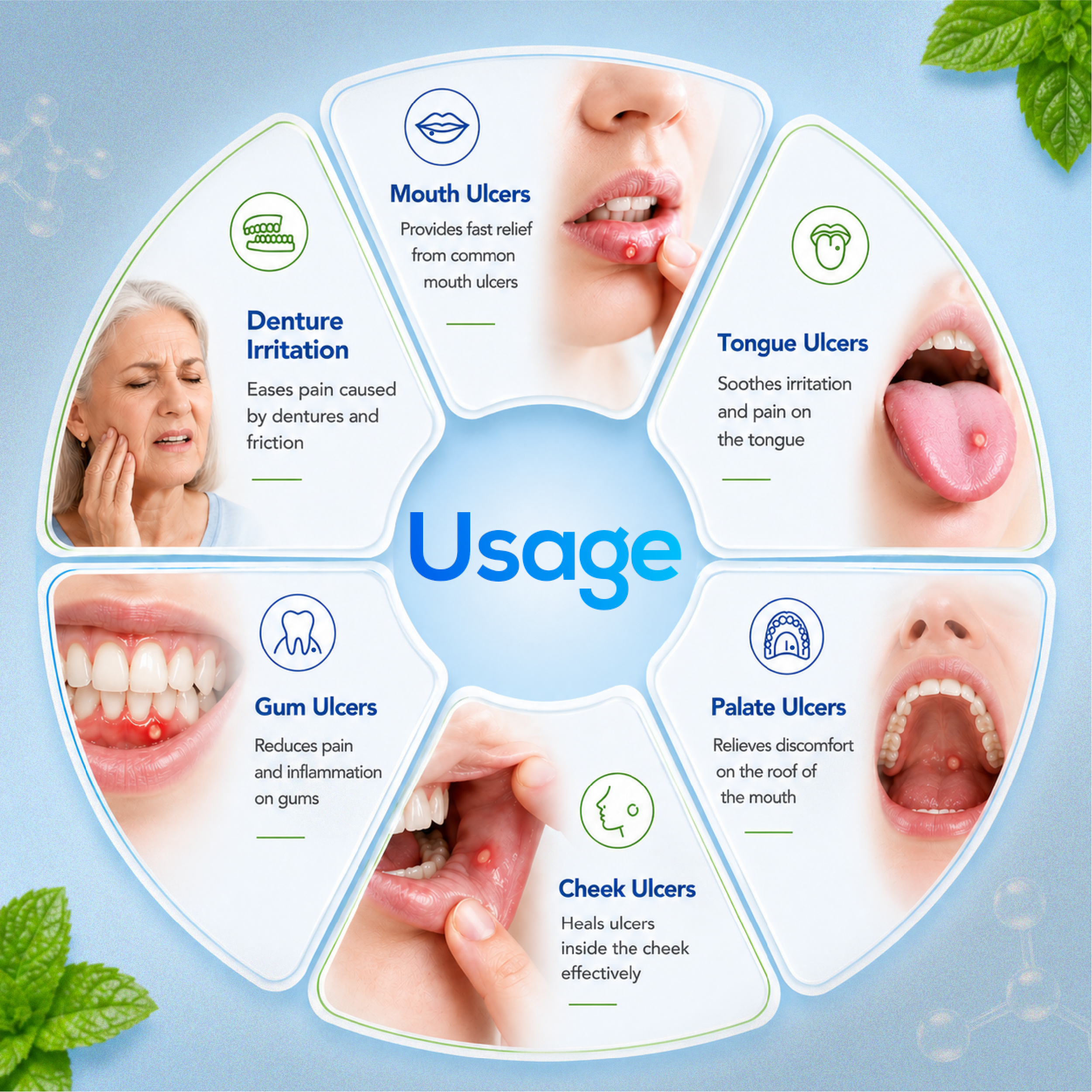 Orasore-Mouth-Ulcer-Gel