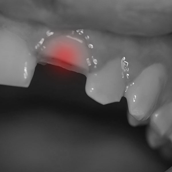 Orasore-Whitening-Toothpaste