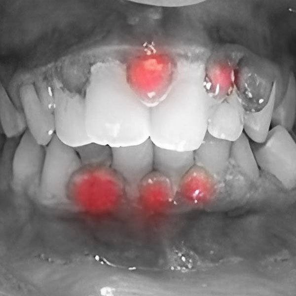 Orasore-Whitening-Toothpaste