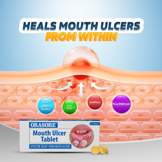 Orasore Mouth Ulcer Tablet
